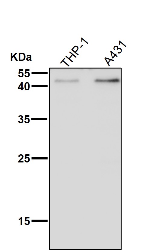 WB - Anti-KLF4/Gklf Rabbit Monoclonal Antibody ABO13501